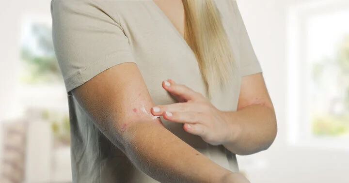 Vanlige årsaker til ekstremt tørr hud